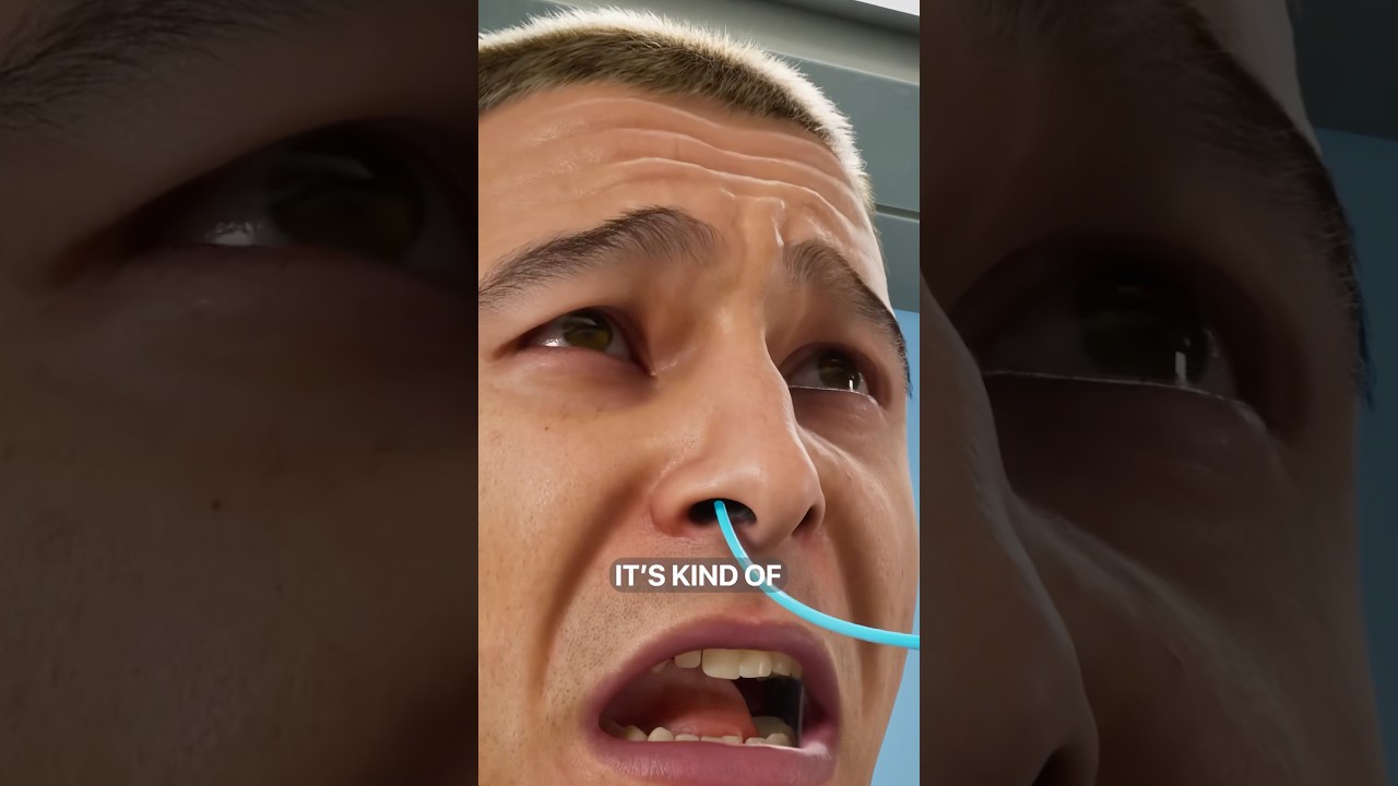 How A Nasal Feeding Tube Works 😨 Surgeon Reacts