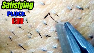 satisfying facial hair plucking FOLLICLES ASMR | Under the Microscope