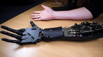 Mind-controlled prosthetic