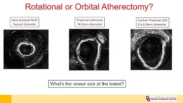 Imaging to guide Rx of calcified lesions_Latif_Coronary On Demand