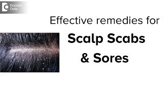 Scabs & Sores on Scalp: Treatment, Causes & Remedies - Dr. Aruna Prasad