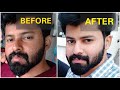 Get brighter skin Naturally in 2 Weeks | No side effects | Tamil | shadhikazeez