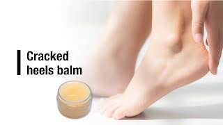 Cracked heels balm