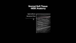 Normal Sonoanatomy of the Musculoskeletal Layers screenshot 2