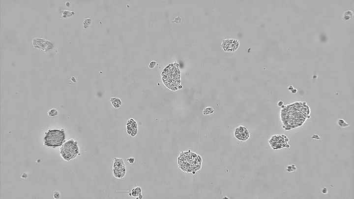 HEP G2 2d 60minINTV time lapse - CytoSMART Lux2