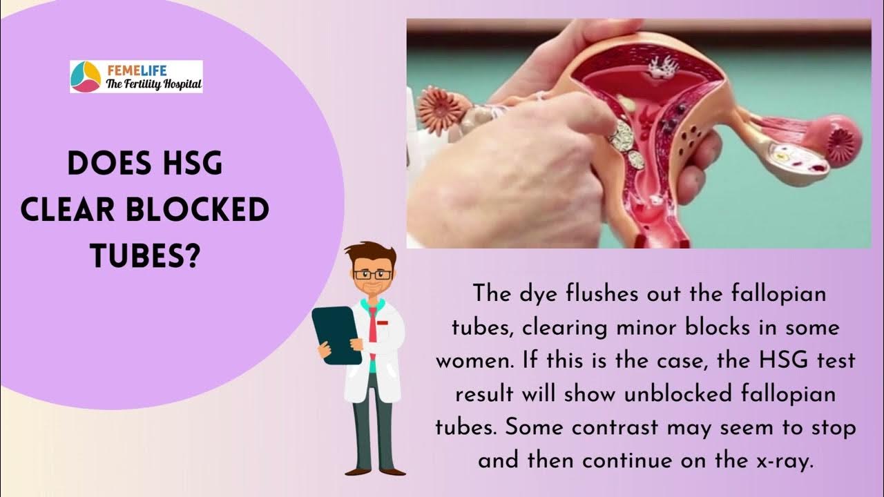 Hysterosalpingography HSG Test Cost YouTube