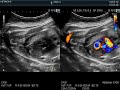 Canine fetal echo, heart of a Boston Terrier fetus (on the 6oth day of gestation) (犬胎児心臓エコー)