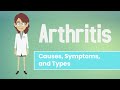 Arthritis - Causes, Symptoms and Treatment Options