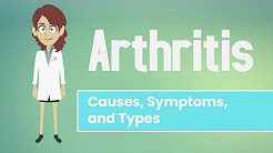 Arthritis - Causes, Symptoms and Treatment Options