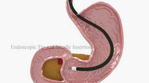 Fiducial Marker 3D Animation
