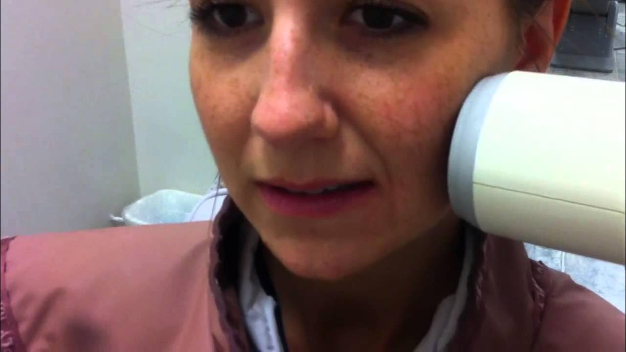 How to take a bitewing YouTube