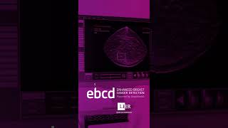 Advantages of Artificial Intelligence Breast Cancer Detection