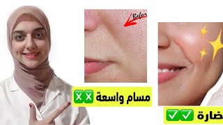 اقوى طريقة لعلاج المسام الواسعه في الوجه و زياده نضاره البشره /التخلص من التصبغات والبشره الدهنيه