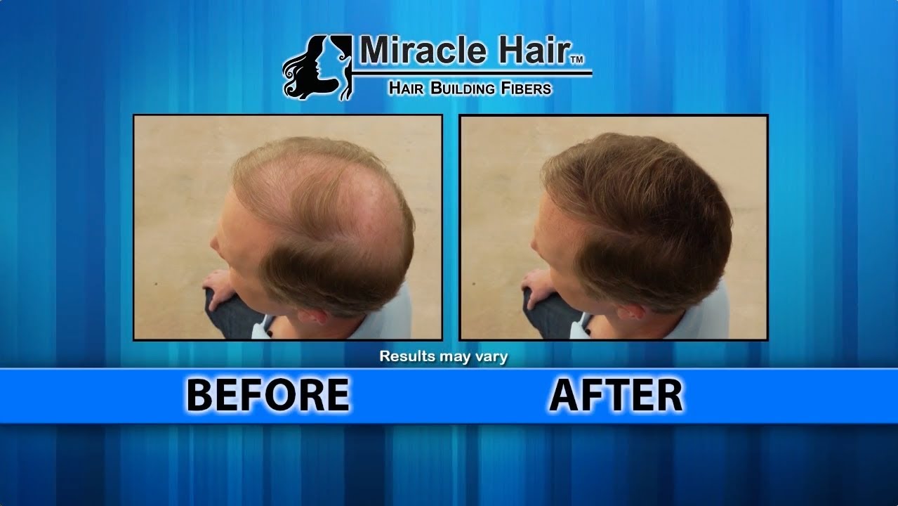 Miracle Hair As Seen On Tv