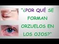 ¿POR QUÉ SE FORMAN ORZUELOS EN LOS OJOS? - RESPUESTA CIENTIFICA