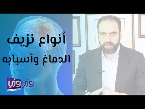 فيديو: كيف يؤثر النزف على الجسم؟