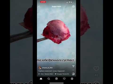 Работают ли ХОНДРОПРОТЕКТОРЫ?