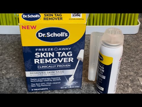 Freeze Away Skin Tag Remover - Skin Tag