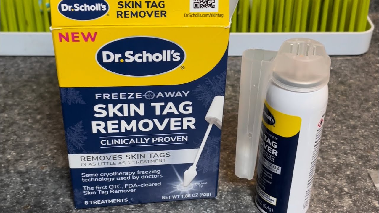 Dr. Scholl's Skin Tag Remover  Application and After 7 day Results 