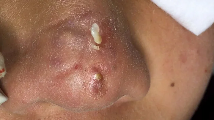 Satisfying and Relaxation with SURI NGUYEN Beauty ...