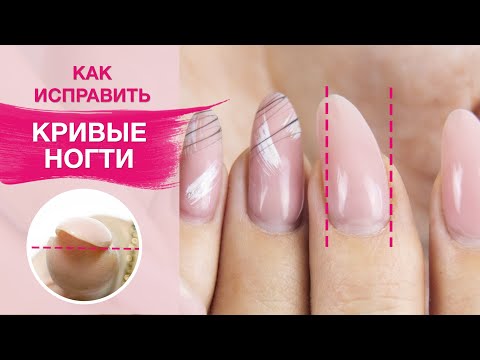 Как исправить кривой ноготь ? | Укрепление ногтей гелем