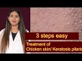 Keratosis pilaris treatment | chicken skin disease | bumps on upper arms | clogged pores treatment