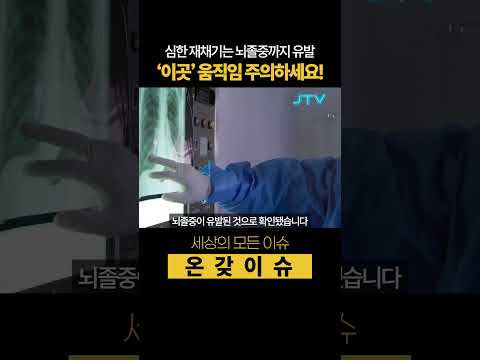 [온갖이슈] 재채기가 뇌졸중 유발?