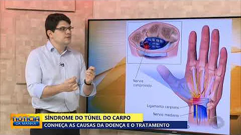 Qual exame que detecta túnel do carpo?