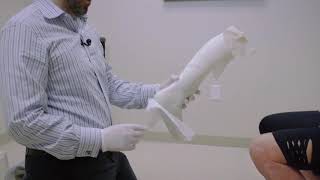 How A Custom Afo Is Made Part 1 The Casting Process