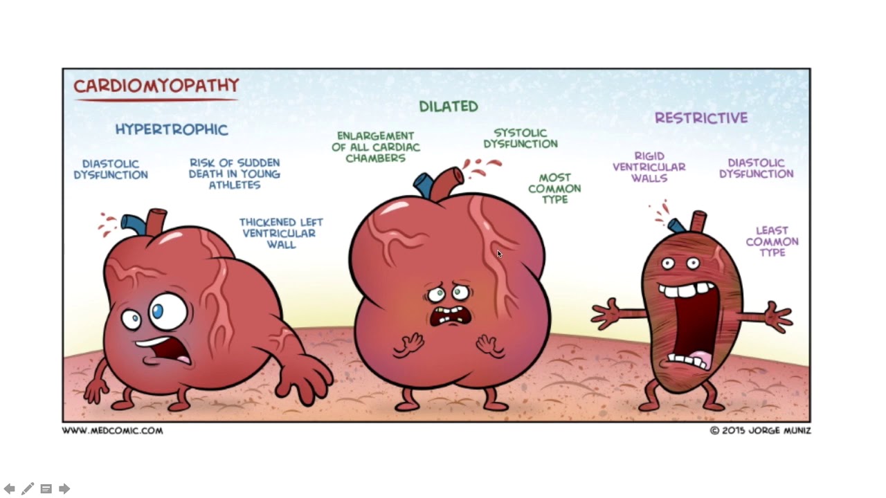 Algorithm 27 : Cardiac Failure
