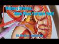 Kidney Stones: How They Torture You!