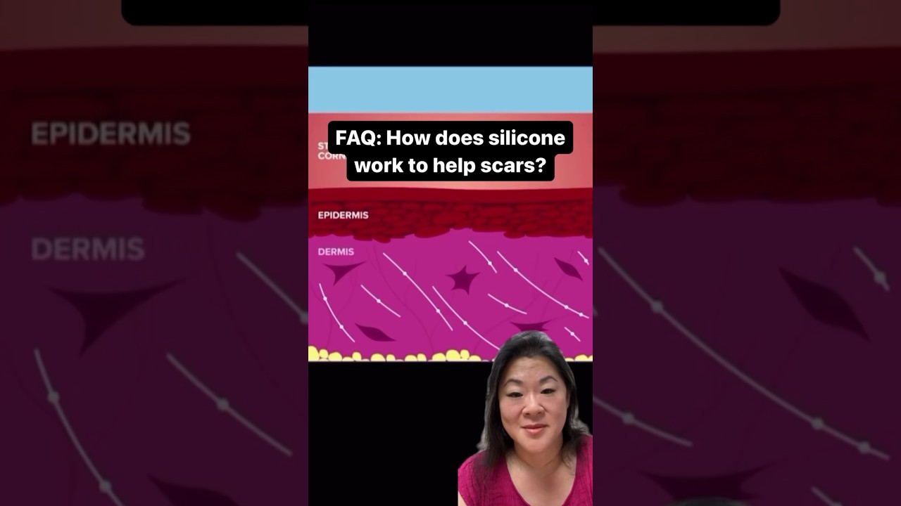 How does silicone work to help scars?