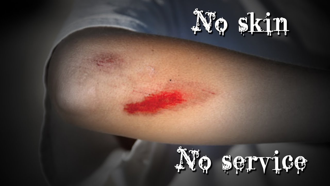 No Skin, No Service (by manen_lyset)