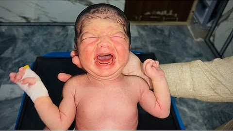 Caring for a Newborn with Neonatal Jaundice – Gentle Tips for Healing 💛👶"