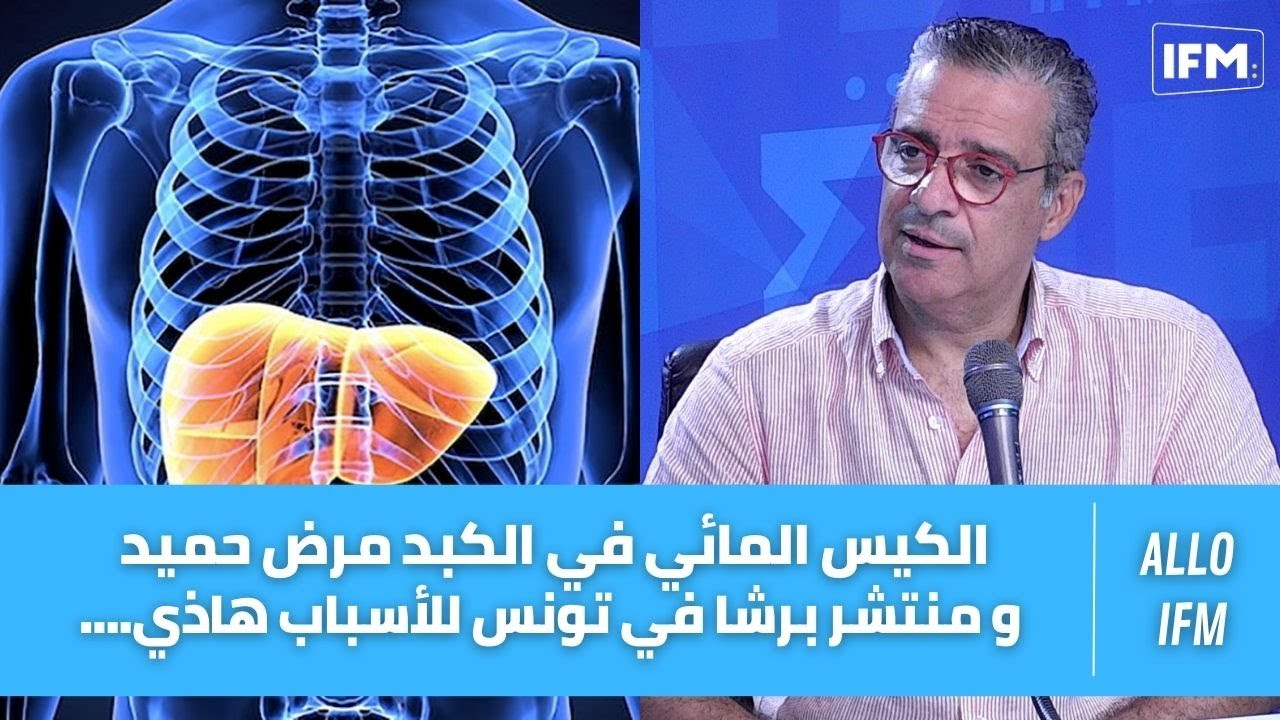 الكيس المائي في الكبد مرض حميد و منتشر برشا في تونس للأسباب هاذي....