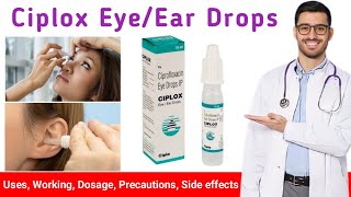 Ciplox Eye/Ear drops uses in hindi | Ciplox Eye Drops in hindi | Ciplox Ear Drops in hindi |