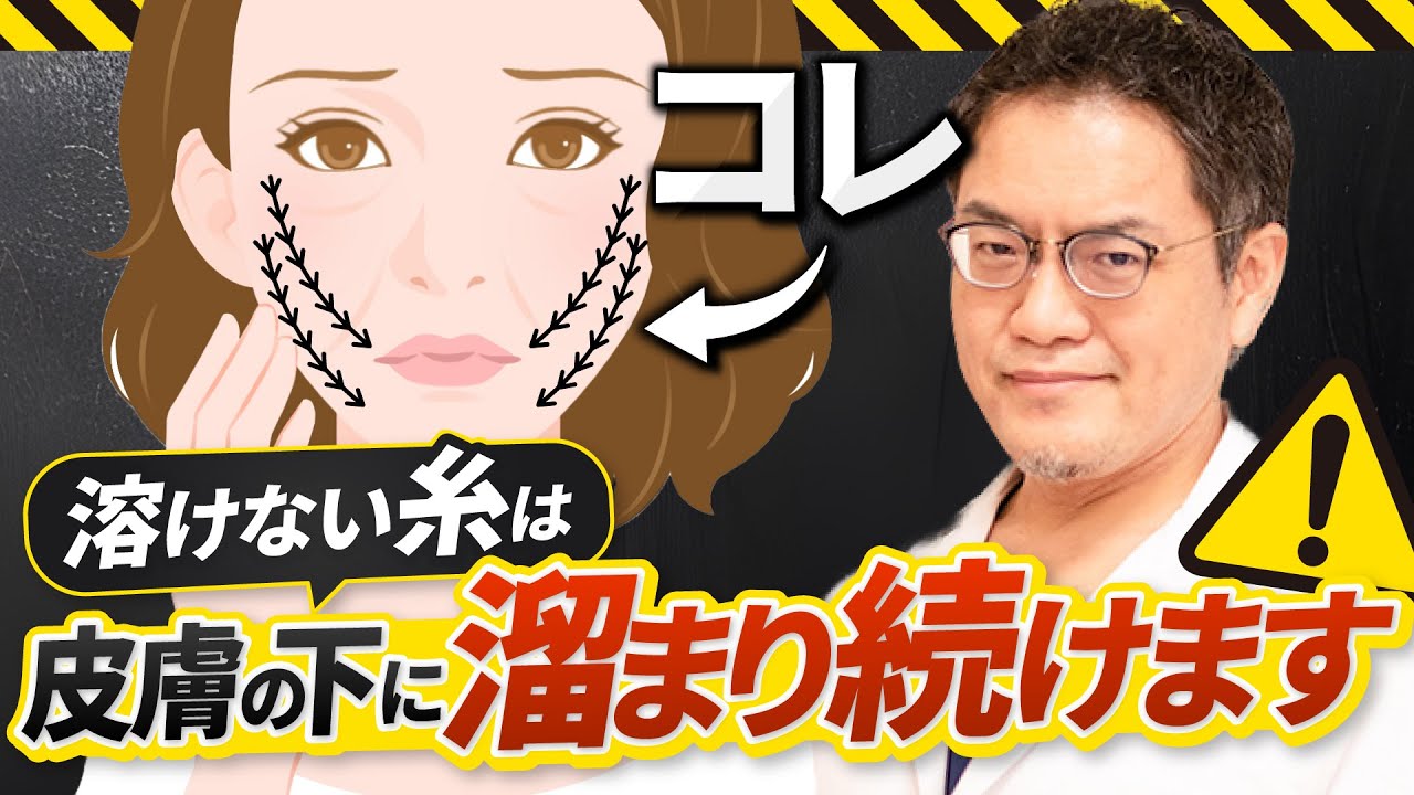 【危険】顔の中に糸が溜まる？！リフトアップで多い不安や疑問に答えます【糸リフト】