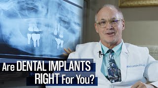 Creating Long Lasting Smiles w/ Dental Implants | Atlanta Dental Implant Specialist | Alpharetta, GA