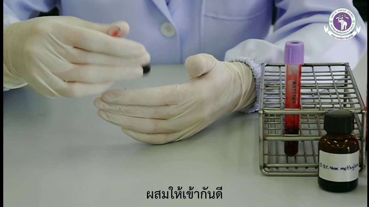 Reticulocyte count - YouTube