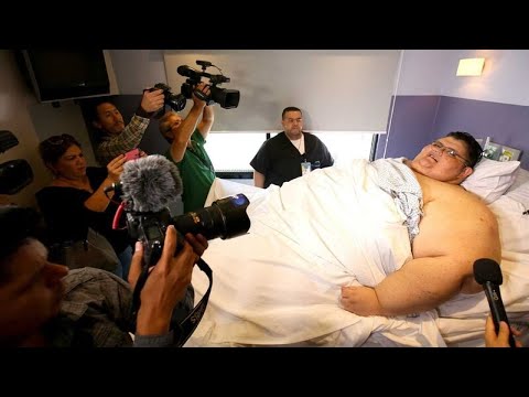 This 1310 Lbs Man Almost Ate Himself To Death - What Happens NEXT Will Make You Cry..?