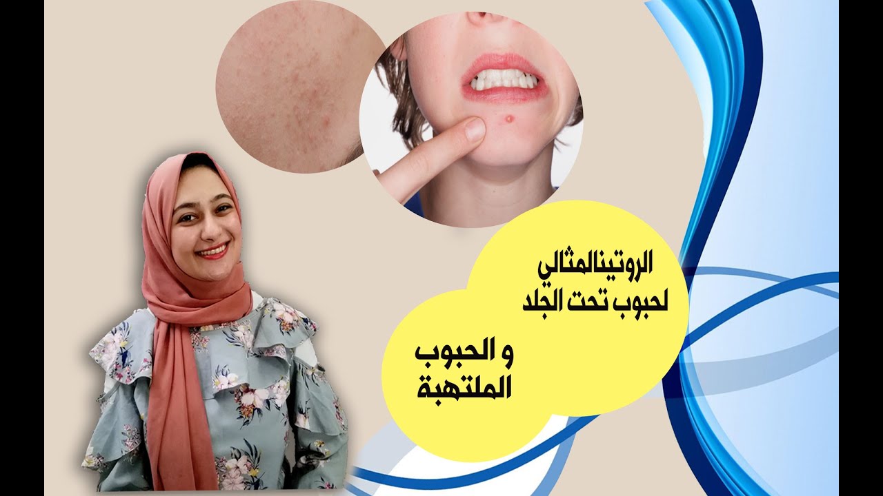 الروتين المثالي للبثور تحت الجلد والبثور الملتهبة يوتيوب ملصقات الأفلام ملصق الأفلام