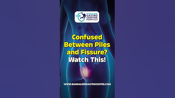 Confused Between Piles & Fissure? Know the Difference in 60 Seconds!