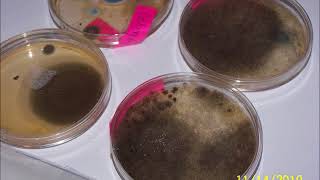Petri-Dishes-Mold-Growth-Penn-View-Apartments.wmv