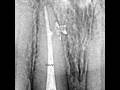 Rct of 11,21,11 with a lateral canal fill#endo #rct #lateralcanal#rootcanal #cwc
