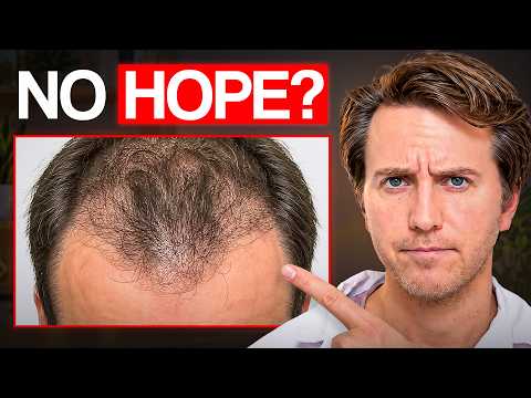 10 Brutal Hair Loss Mistakes That Are Making You Go Bald Faster!