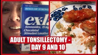 Adult Tonsillectomy - Day 9 and 10