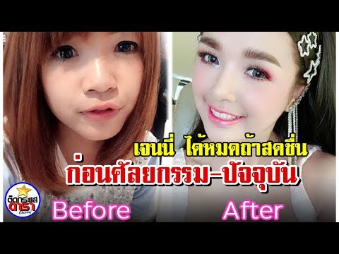 เจนนี่ ได้หมดถ้าสดชื่น ก่อนศัลยกรรม-ปัจจุบัน กราฟความสวยพุ่งแรงจนแทบจำไม่ได้ !