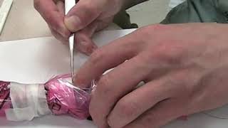 Cricothyrotomy