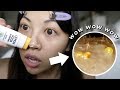 Another "BLACKHEAD MELTING" product... lets go.