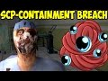 SCP – Containment Breach | Хирург и орущие глаза SCP-066